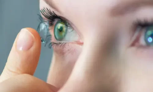 Custom and scleral contact lenses Calgary